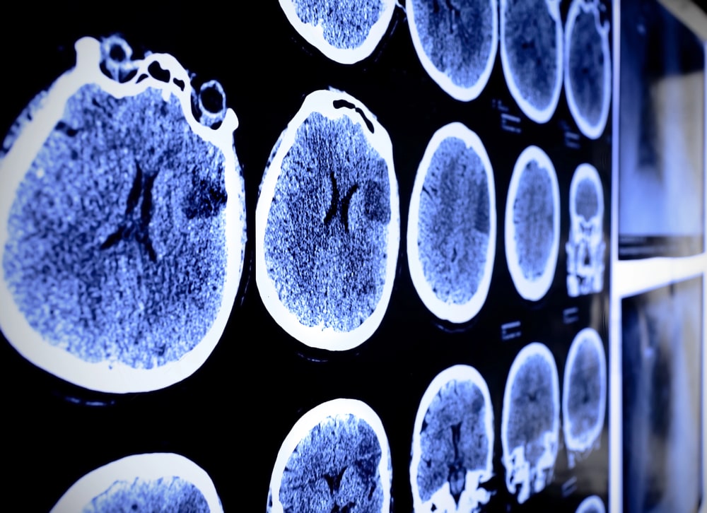 The Gordon Law Firm - California brain injury lawyer