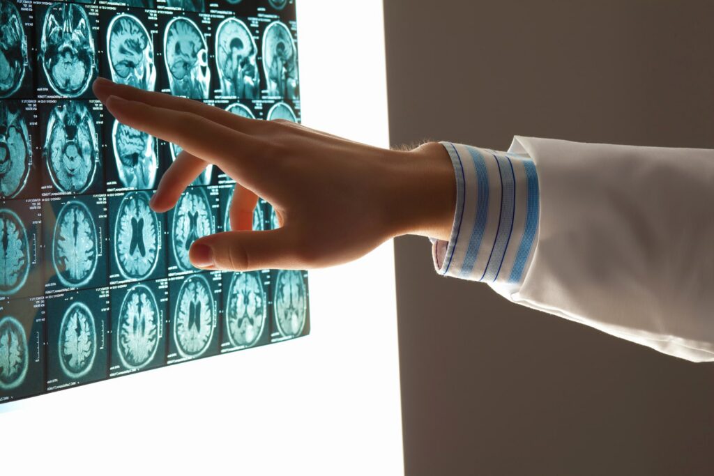 brain injury lawyer White Rock, CA